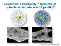Abbildung 21: Anabole Osteoporosetherapie