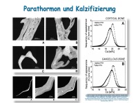 Abbildung 22: Anabole Osteoporosetherapie