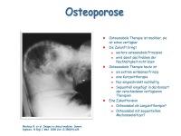 Abbildung 29: Anabole Osteoporosetherapie