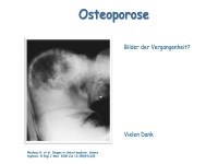 Abbildung 30: Anabole Osteoporosetherapie