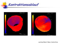 Abbildung 7: Kontraktionsablauf