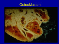 Abbildung 9: Osteoklasten