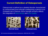 Abbildung 22: Osteoporose - Definition