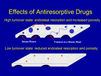 Abbildung 29: Antiresorptiva