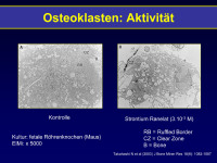 Abbildung 9: Osteoklasten