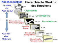 Abbildung 3: Knochenqualit�t