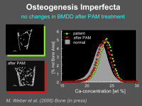 Abbildung 20: Osteogenesis Imperfecta