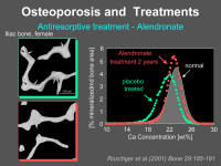 Abbildung 22: Osteoporose - Behandlung