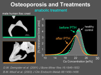 Abbildung 23: Osteoporose - Behandlung