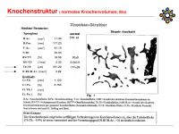 Abbildung 13: Knochenstruktur