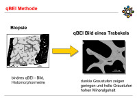 Abbildung 17: qBEI-Methode
