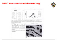 Abbildung 21: BMDD Knochenmineraldichteverteilung