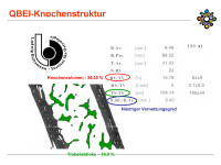 Abbildung 31: qBEI-Knochenstruktur