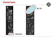 Abbildung 35: Corical bone