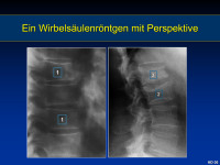 Abbildung 7: R�ntgen - Wirbels�ule