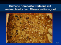 Abbildung 18: Humane Kompacta