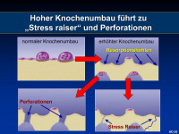 Abbildung 19: Stress raiser