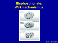 Abbildung 8: Bisphosphonat