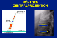 Abbildung 13: R�ntgen