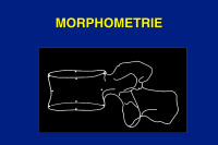 Abbildung 16: Morphometrie