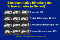 Abbildung 18: Schweregrad