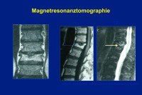 Abbildung 38: Magnetresonanztomographie