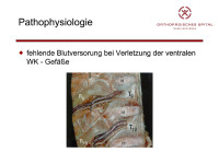 Abbildung 11: Pathophysiologie