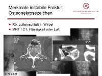 Abbildung 13: Osteonekrosezeichen