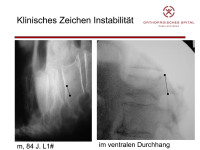 Abbildung 14: Instabilit�t