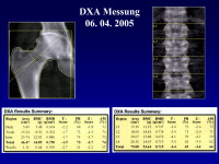 Abbildung 5: DXA-Messung