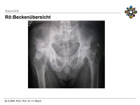 Abbildung 6: R�ntgenbild