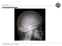 Abbildung 7: R�ntgenbild