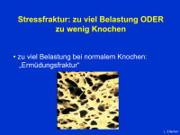 Abbildung 7: Stressfrakturen