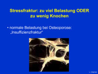 Abbildung 8: Stressfrakturen