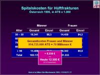 Abbildung 4: Osteoporose