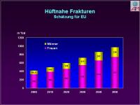 Abbildung 34: Osteoporose