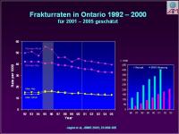 Abbildung 37: Osteoporose