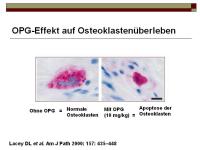 Abbildung 11: RANKL/RANK/OPG-System