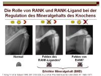 Abbildung 12: RANKL/RANK/OPG-System