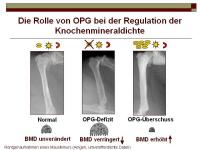 Abbildung 16: RANKL/RANK/OPG-System