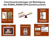 Abbildung 20: RANKL/RANK/OPG-System