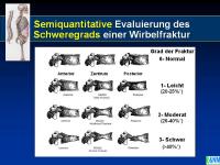 Abbildung 27: Raloxifen