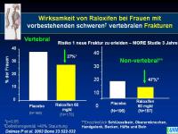 Abbildung 29: Raloxifen