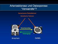 Abbildung 12: Osteoporose - Arteriosklerose