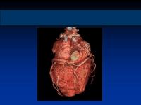 Abbildung 26: Osteoporose - Arteriosklerose