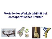 Abbildung 2: Osteosynthese