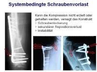 Abbildung 6: Osteosynthese