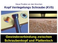 Abbildung 7: Osteosynthese