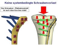 Abbildung 11: Osteosynthese