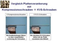 Abbildung 14: Osteosynthese